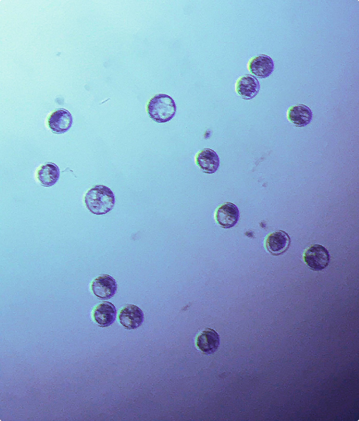 Trans Embryo billede af embryoner